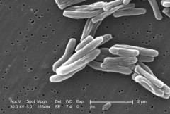Роберт Кох выступил с сенсационным сообщением — ему удалось выделить бактерию, вызывающую туберкулез