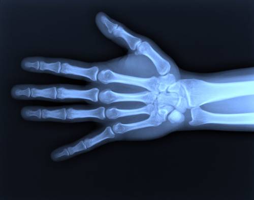 8 ноября 1895 года были открыты рентгеновские лучи